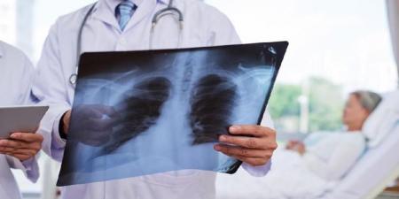 بعد از غلبه کروناویروس بر سیستم ایمنی شما چه اتفاقی در بدن و ریه شما می‌افتد؟