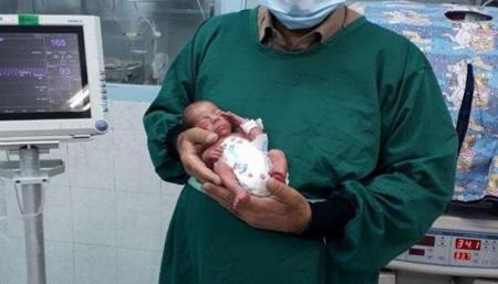 نوزاد ۸۰۰ گرمی یزدی کرونا را شکست داد + عکس