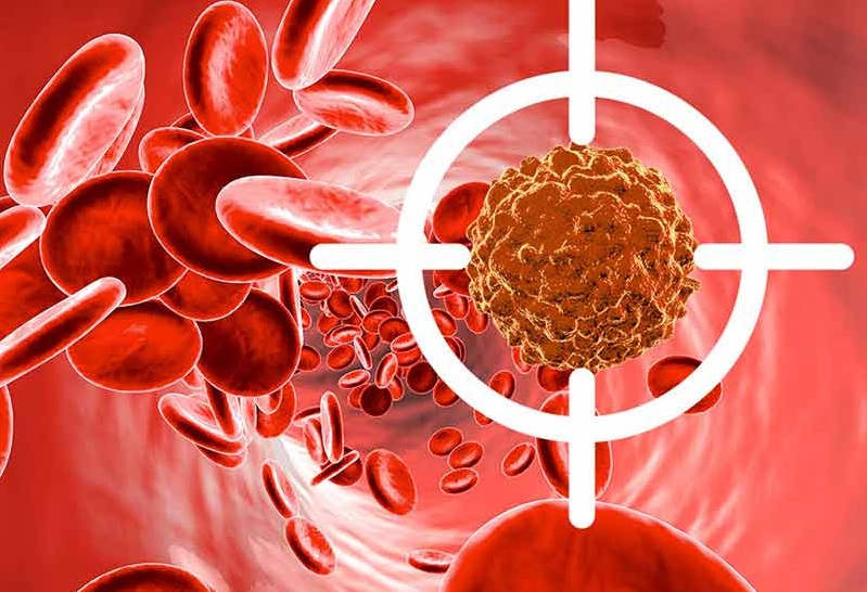 سرطان خون چگونه به بدن حمله می‌کند؟