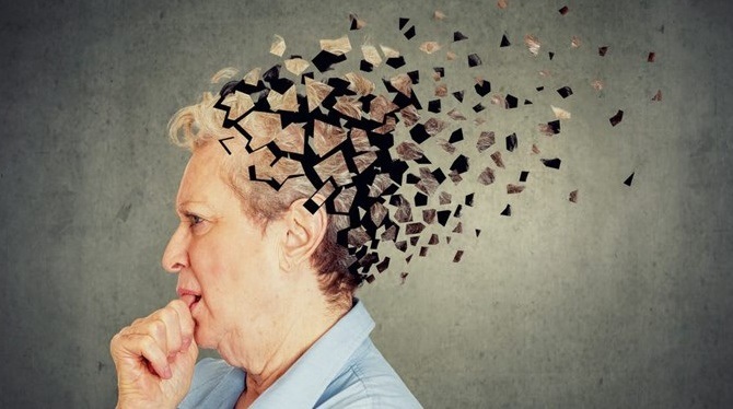 می‌توان قبل از بروز علائم، آلزایمر را تشخیص داد؟