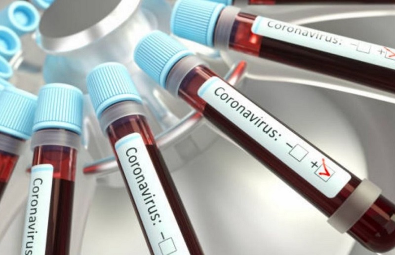 دو گروه خونی که بیشتر تحت تاثیر کروناویروس‌اند