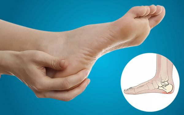  خار پاشنه پا چیست چه علائمی دارد و چگونه درمان می شود؟