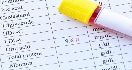 اگر اسید اوریک تان بالاست به این خوراکی ها لب نزنید 