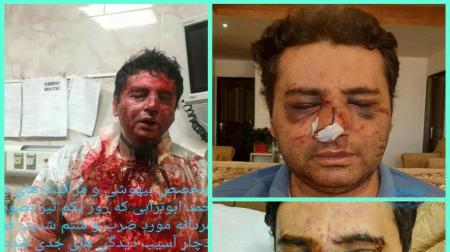 پزشک پیرانشهری که مورد ضرب و شتم وحشتناک قرار گرفت + عکس