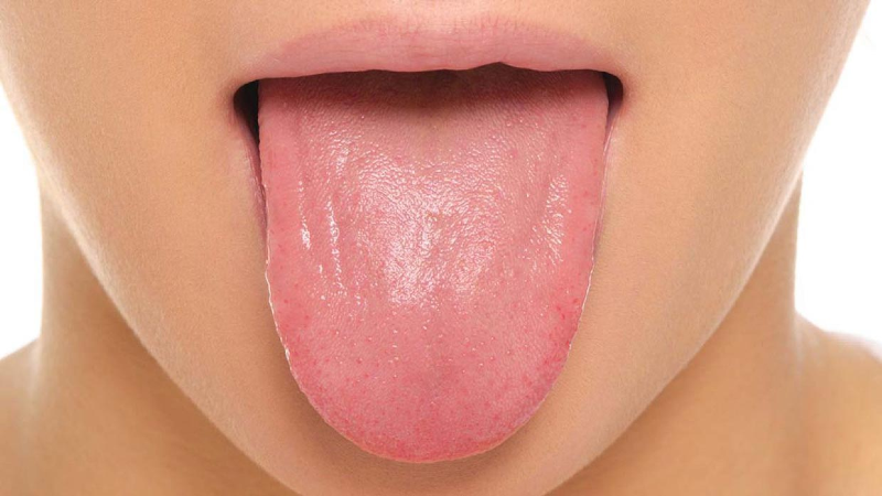 سلامت بدن را روی زبانتان پیدا کنید
