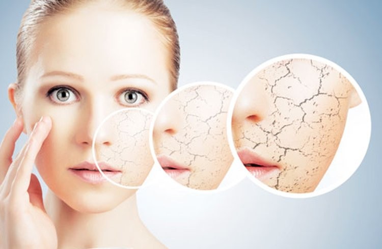 راه های موثر درمان خشکی پوست کدامند؟