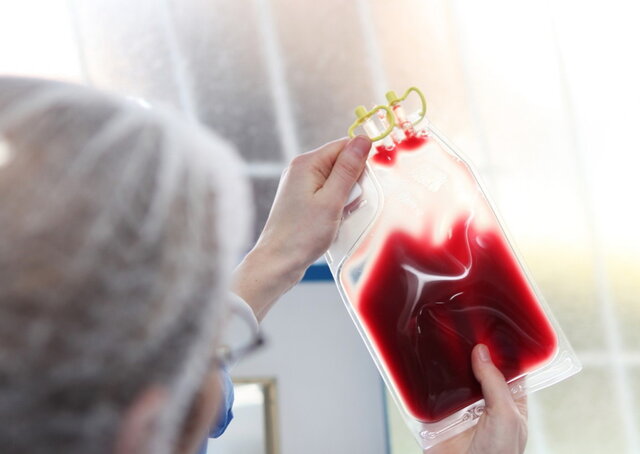 علل کاهش تمایل خانواده‌ها به ذخیره سازی خون بند ناف