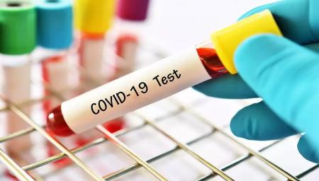  کدام تست قطعی ترین شیوه تشخیص کرونا است؟