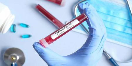 FDA آزمایش جدید بزاق را برای تشخیص COVID-19 تأیید می کند 