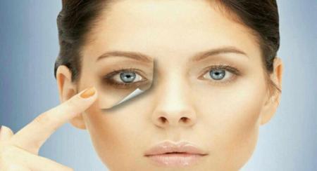  کاهش گودی و سیاهی زیر چشم را با ترک ۶ عادت 