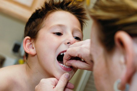 خرد شدن ناگهانی دندان نشانه چیست؟