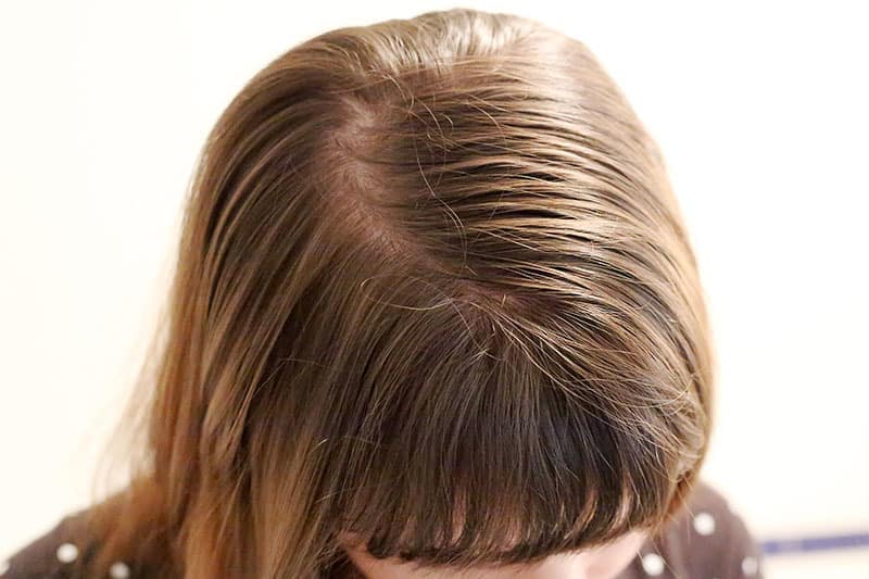 درمان مو های نازک و ضعیف با 5 روش موثر خانگی