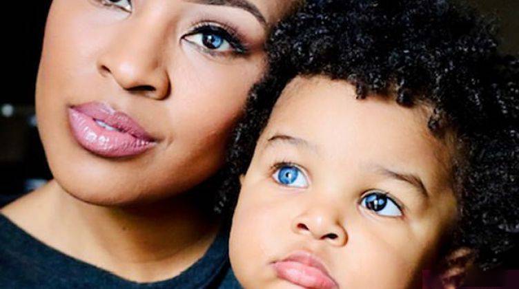 چشمان شگفت‌انگیز مادر و فرزند با اختلال ژنتیکی+عکس