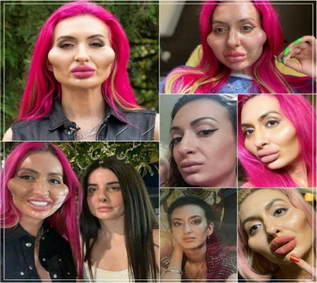 گونه‌های عجیب زن ۳۰ ساله خبرساز شد +عکس
