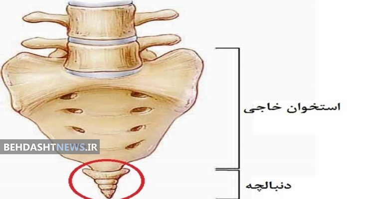 علت و درمان درد دنبالچه