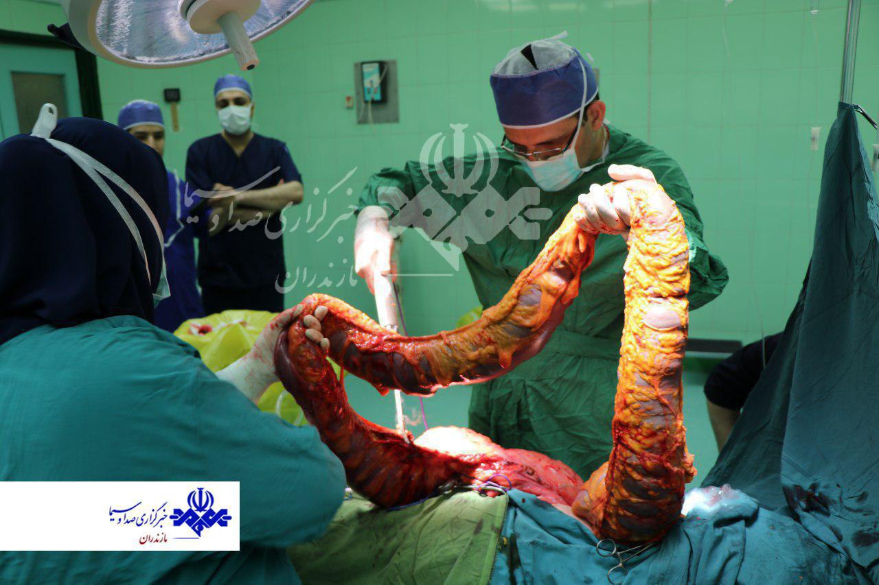 تصویر باورنکردنی از خارج کردن روده 5 کیلویی زن شمالی