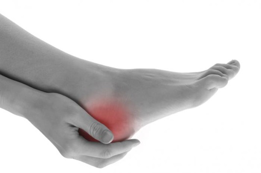 8 علت درد پاشنه پا | با مشاهده این علائم فورا به پزشک مراجعه کنید