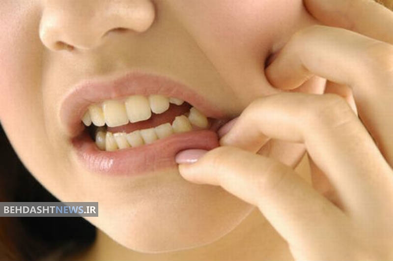  بایدهای پیشگیری از پوسیدگی دندان 