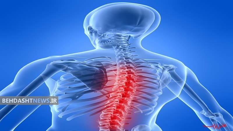 علائم آسیب مهره های ستون فقرات