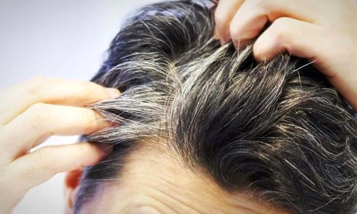 روش‌هایی جالب برای جلوگیری از بروز مو‌های سفید