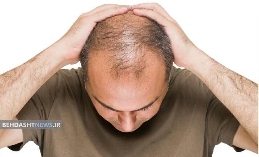  ۵ راه موثر برای کاهش آسیب موها به دلیل تابش نور خورشید