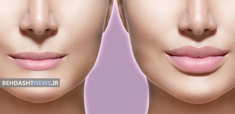 تزریق چربی صورت برای چه افرادی مناسب‌تر است؟ 