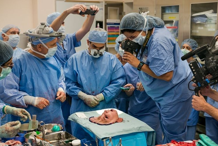 تصویر فوق العاده از عملیات پزشکی پیوند چهره انسان + عکس