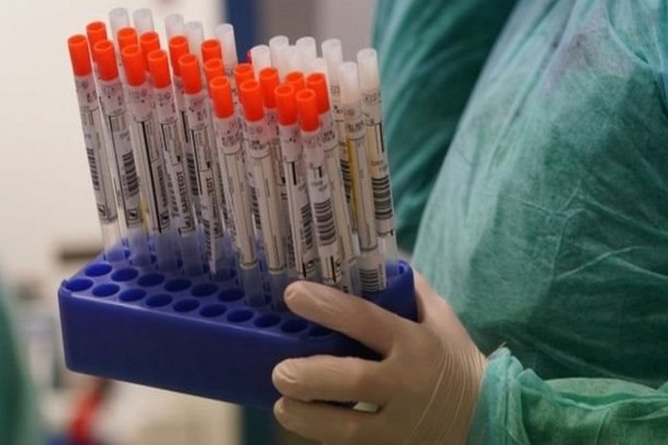 آزمایش جدیدی که میزان خطر کرونا را مشخص می‌کند