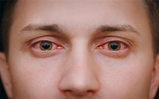 کشف علامت خطرناک جدید در مبتلایان به کرونا 