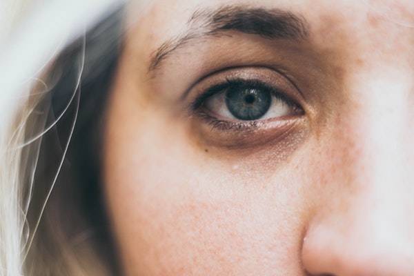  راه چاره ای برای سیاهی و کبودی دور چشم