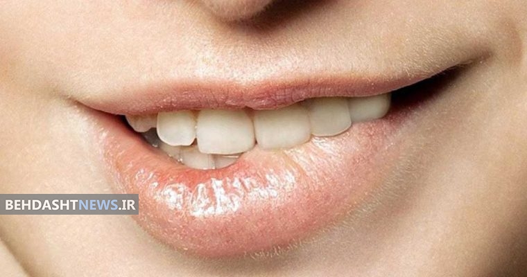 آیا گاز گرفتن لب‌ها باعث سرطان می‌شود؟