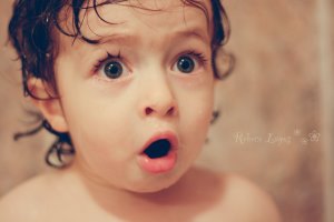 دختری که هر 2 ماه پوست می اندازد+ عکس