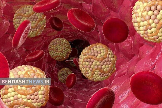  مراقب کدام نوع از چربی‌های خون باشیم