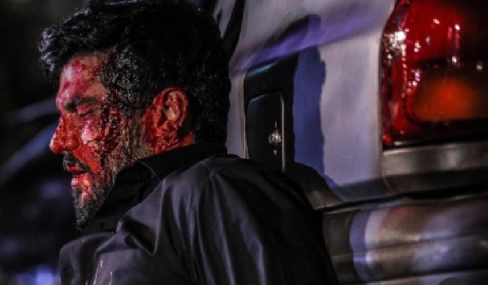 حادثه خونین برای آقازاده سرشناس + عکس