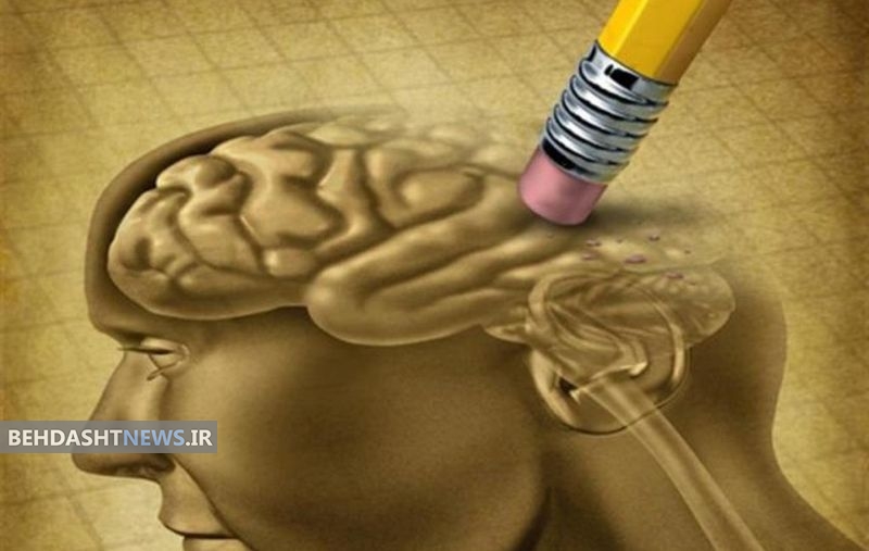 ارتباط صرع خاموش با علائم آلزایمر