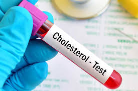 کلسترول بد و کلسترول خوب یعنی چه؟+راه افزایش کلسترول خوب