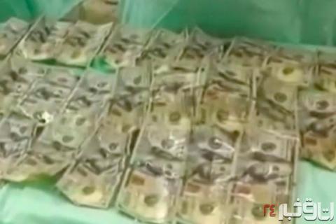 زن کلمبیایی 7 هزار دلار را قورت داد +عکس