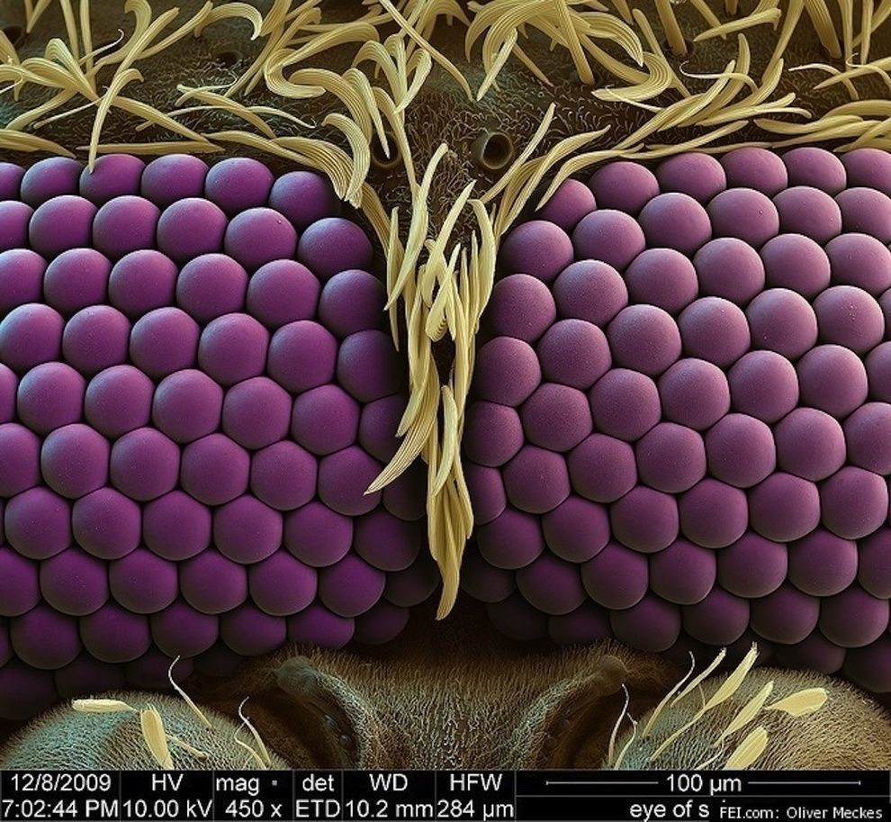 تصویری زیبا از چشم های پشه زیر میکروسکوپ! + عکس