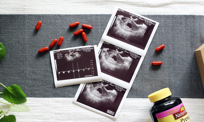 با داشتن سرطان می توان باردار شد؟