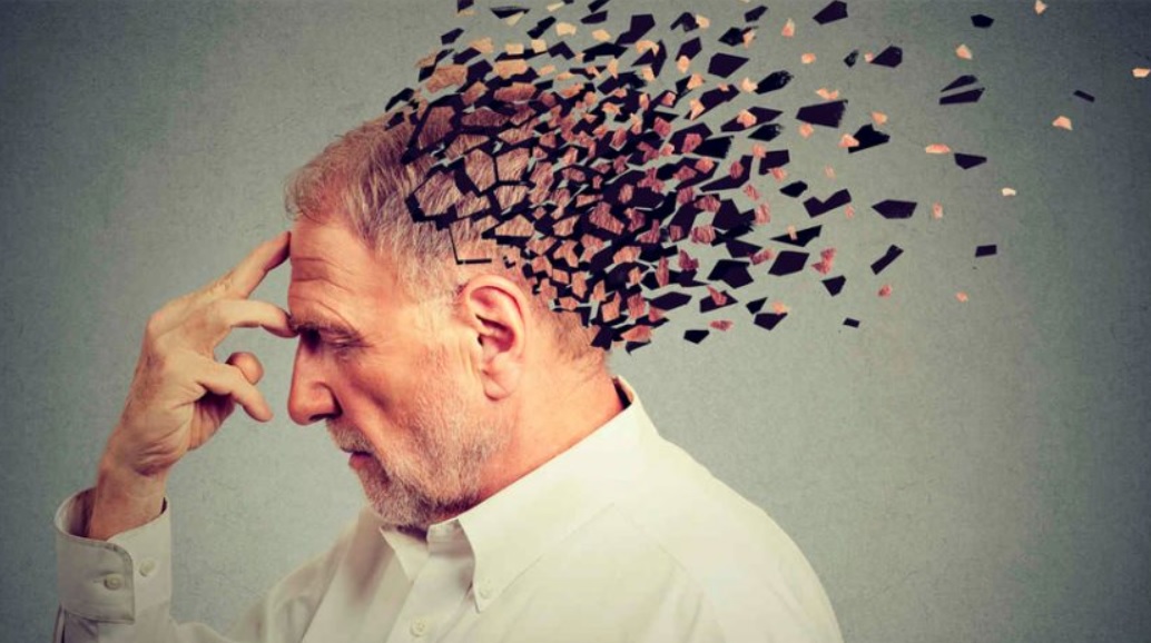 تشدید علائم آلزایمر به‌دلیل چاقی