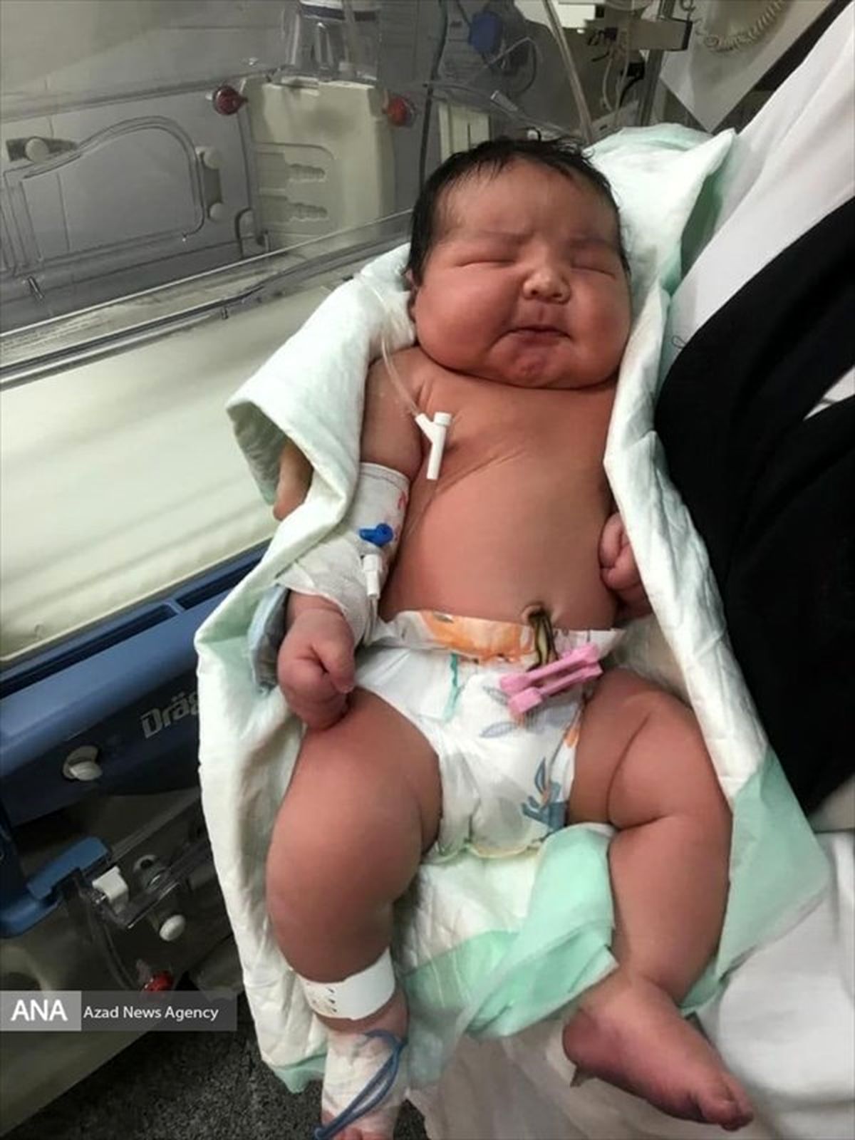 تصویری از نوزاد ۶ کیلویی در تهران