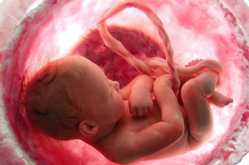 جزئیات اجرای «غربالگری جنین» در وزارت بهداشت اعلام شد