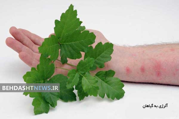  گیاهانی که باعث راش پوستی می شوند