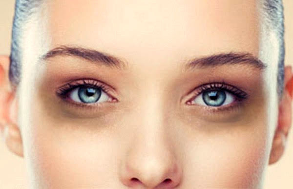  علامتی در چشم که نشان از بیماری خطرناک دارد