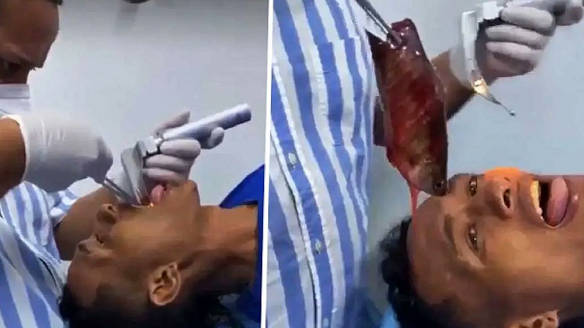 بیرون کشیدن ماهی از گلوی ماهیگیر! + عکس