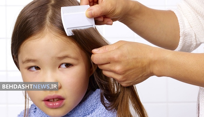 چگونه شپش را بشناسیم و در خانه درمانش کنیم؟