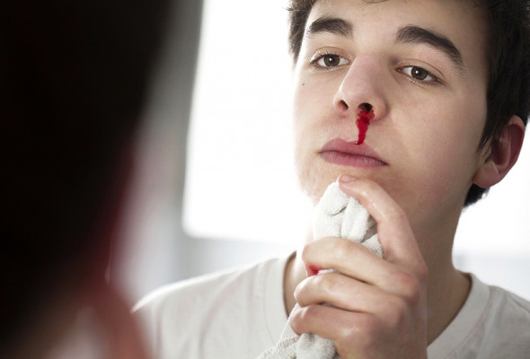 علل خونریزی بینی یا خون دماغ چیست؟+عکس