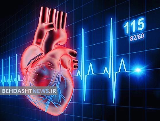 علائم خاموش فیبریلاسیون دهلیزی کدام است؟