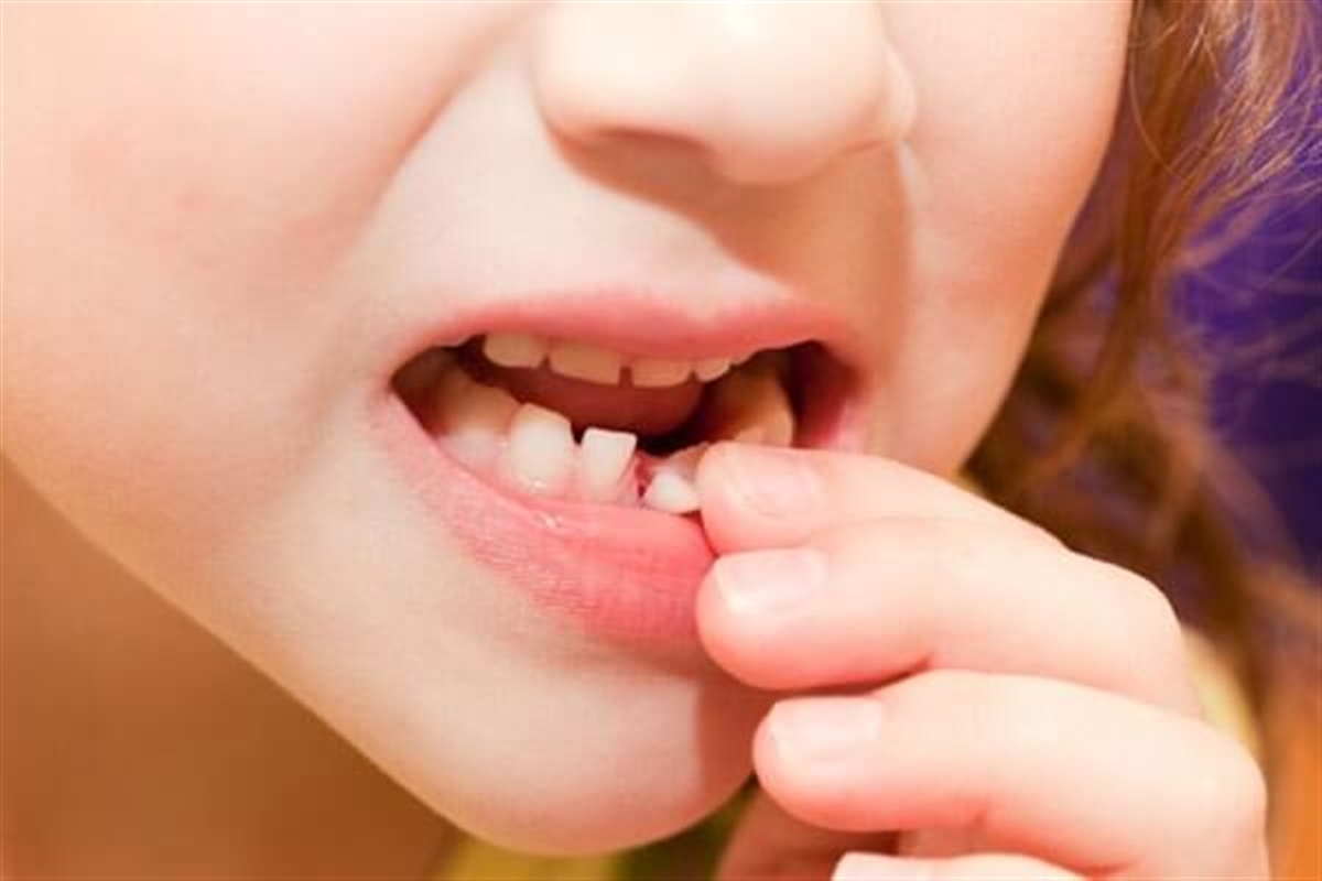 نکاتی راجع به چکاب دندان کودکان