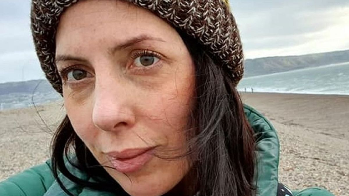 زنی که با خوردن میگو بیمار شد! +عکس